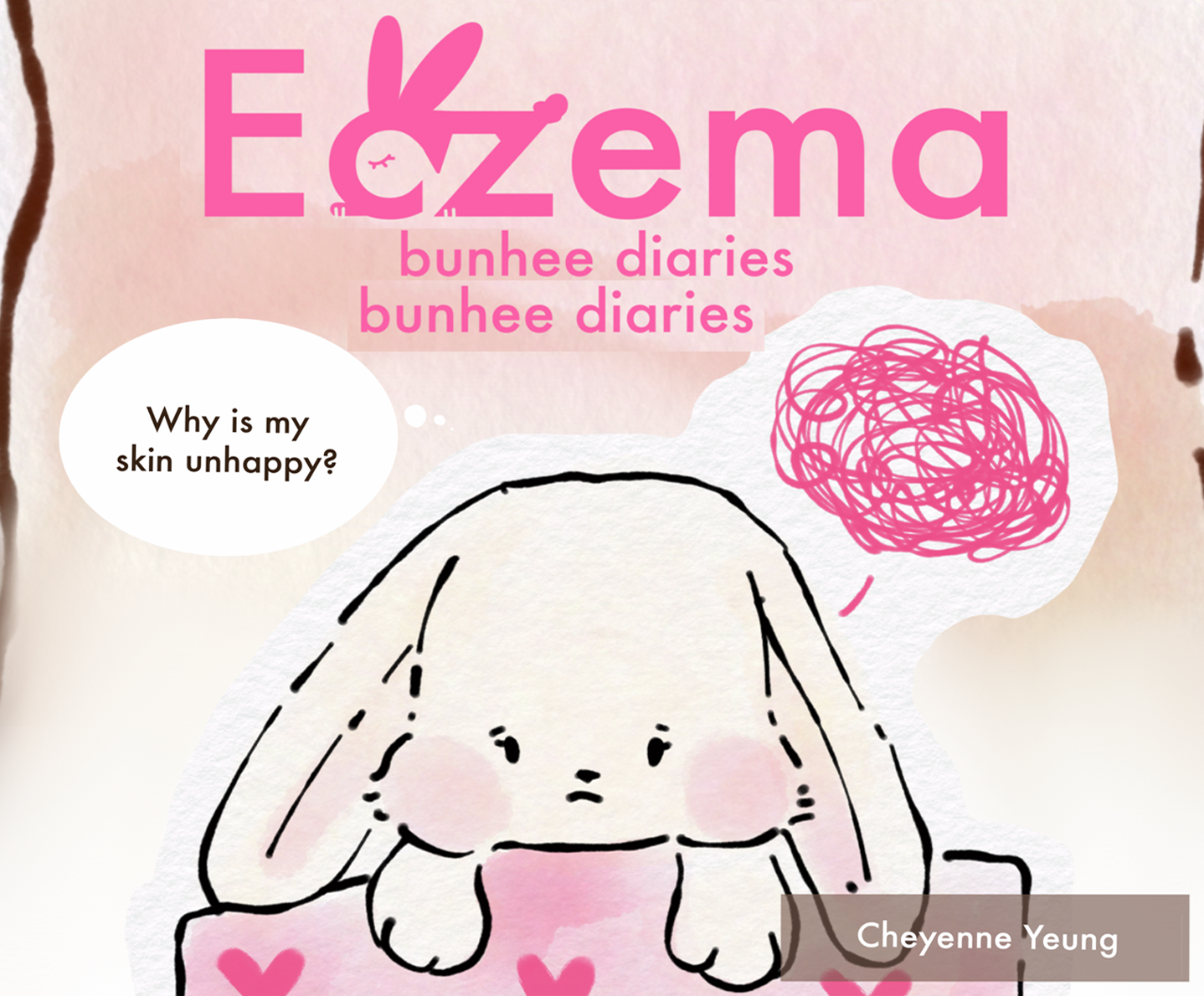 eczema front